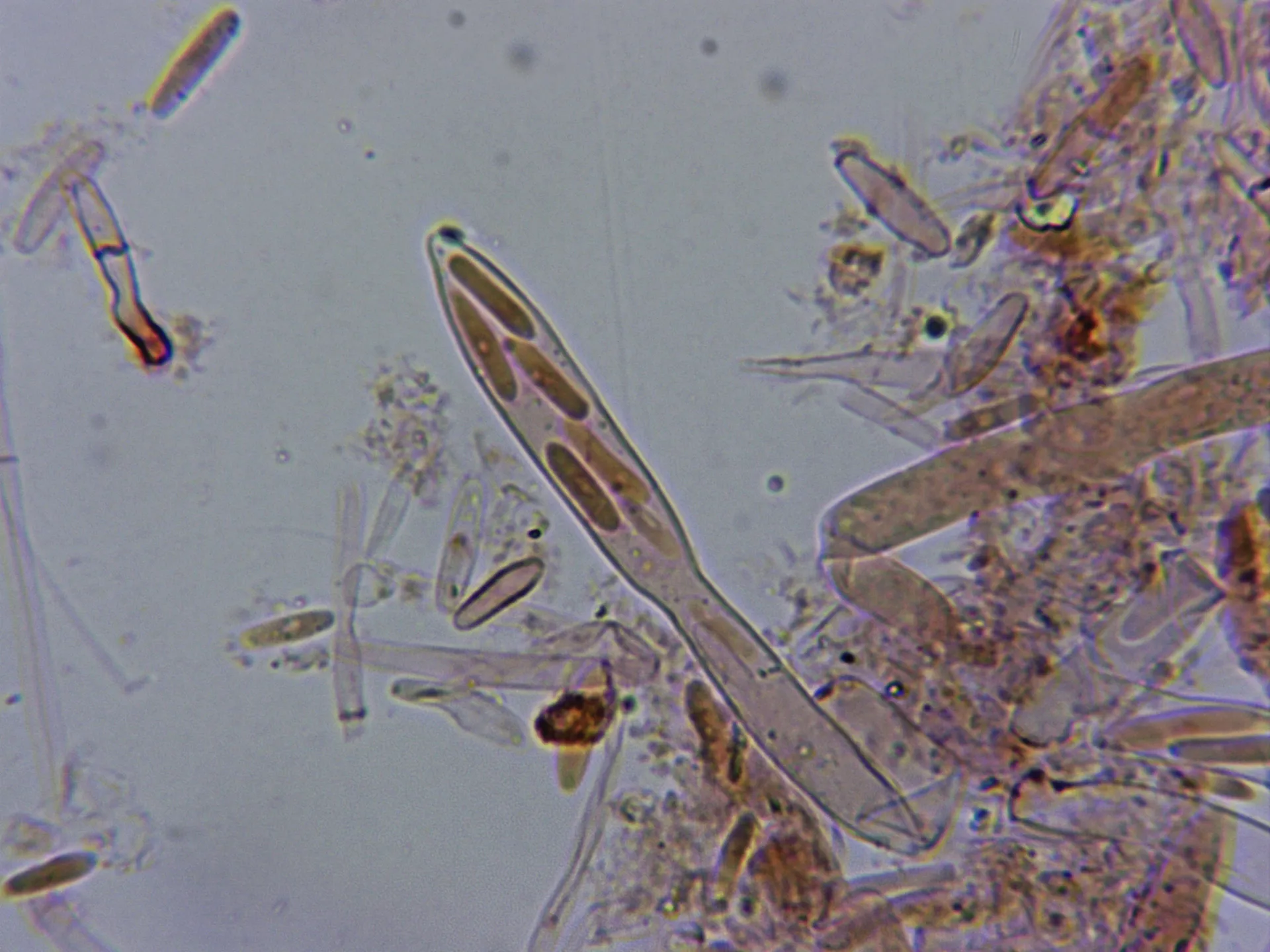 Microscopía de Mitrula paludosa - 10 - Asca